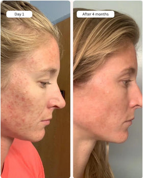 Averr Aglow Clear Skin Elixir spa scene with refreshing glow.