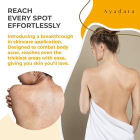 AYADARA Acne Body Spray Chest 3-Pack targets chest acne with versatile, fast-drying care.