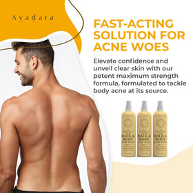 AYADARA Acne Body Spray Usage 3-Pack demonstrates easy application and fast drying benefits.