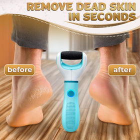 AZZORI foot sander dust cap helps keep it clean.