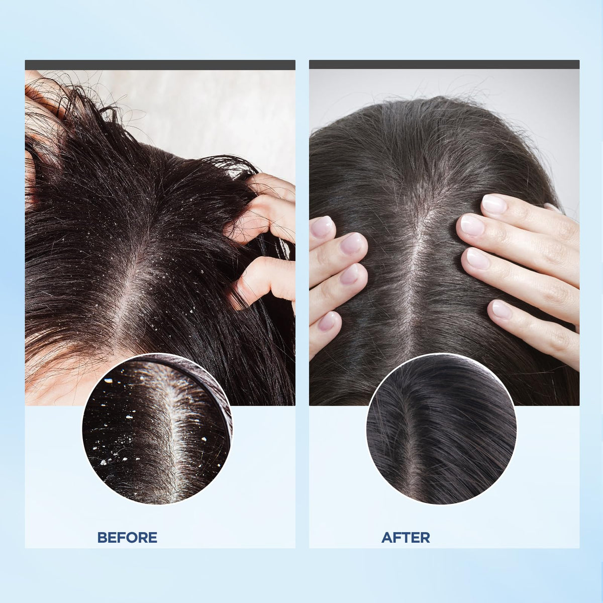 Bablabear Coconut Oil and Charcoal ingredients nourish and clarify the scalp