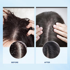 Bablabear Coconut Oil and Charcoal ingredients nourish and clarify the scalp