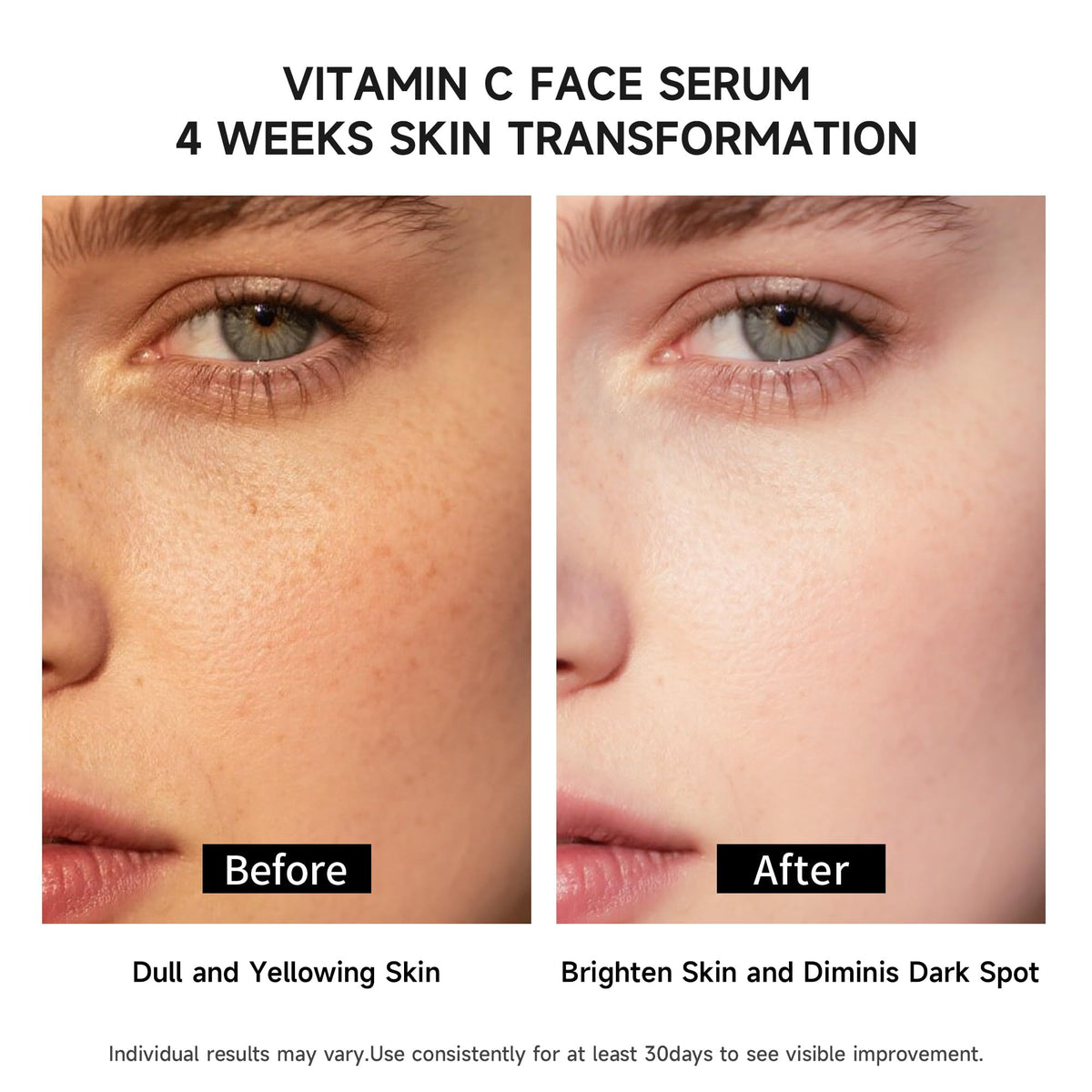 BACHERI 4D hyaluronic acid with aloe vera provides multi-layer hydration.