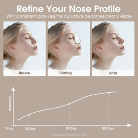 Baifuduo intelligent bridge shaper adapts to diverse nose shapes for comfortable reshaping.
