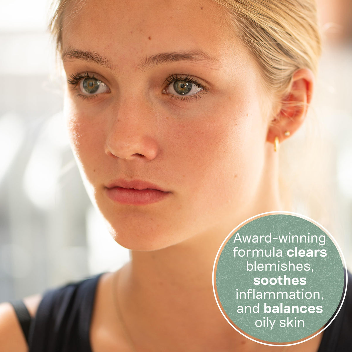 Balance Me kanuka oil action image emphasizing acne-fighting botanicals