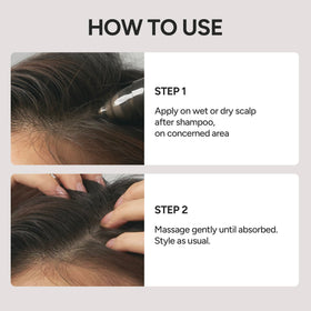 BANANAL Korean hair care solution for advanced scalp routines.