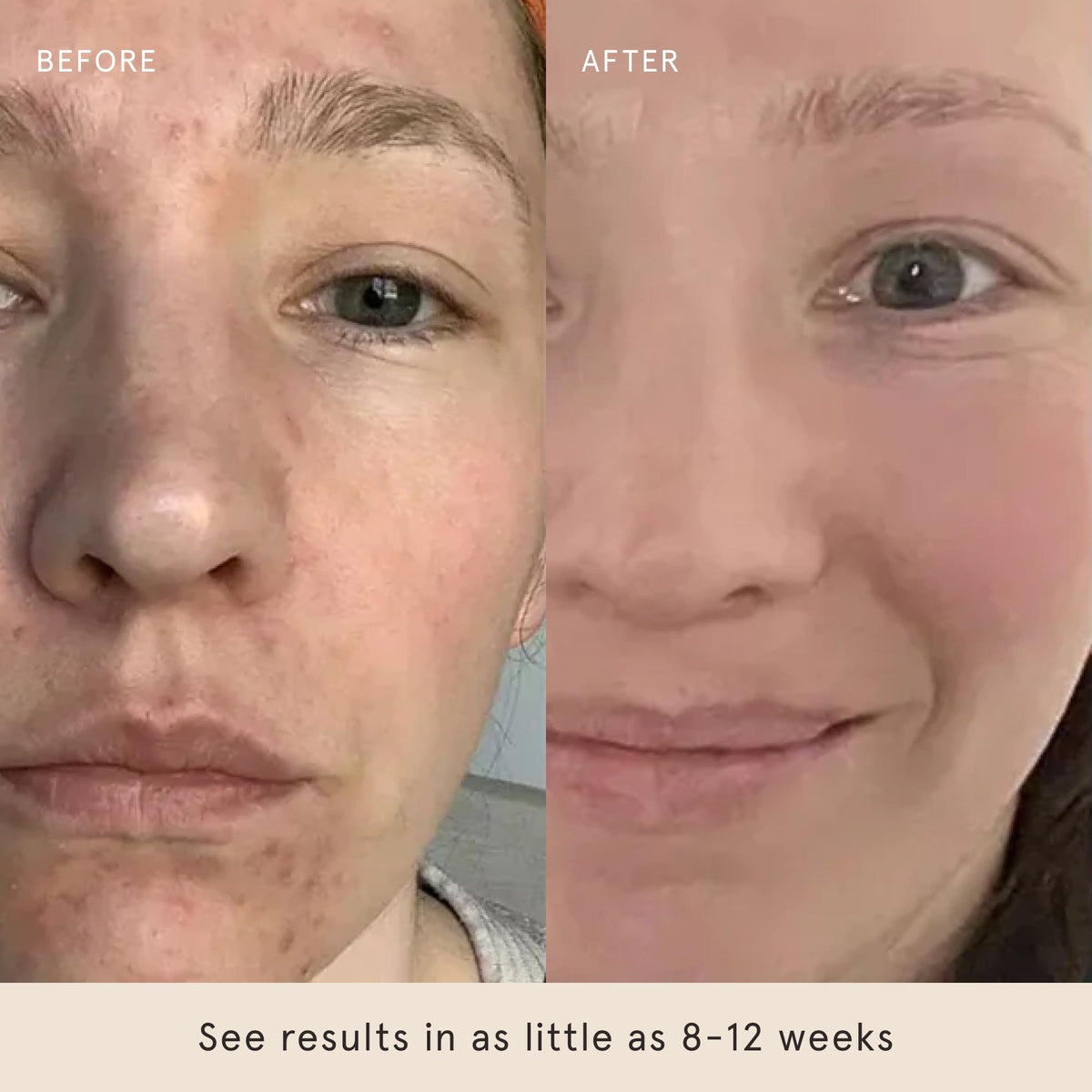 Barefaced Glow Peel Pad in bathroom shelf as part of skincare routine.