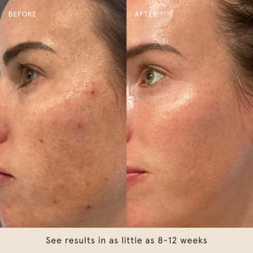 Barefaced serum dispense action illustrating precise nightly application
