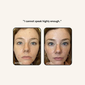 Barefaced ingredients preview noting RetinAL and Bakuchiol for resilience