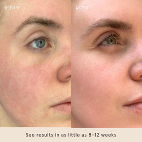 Barefaced Sheer Protection SPF 50+ swatch on skin demonstrates sheer coverage