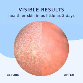 Barefoot Scientist High Dive cream texture closeup highlighting rich hydration