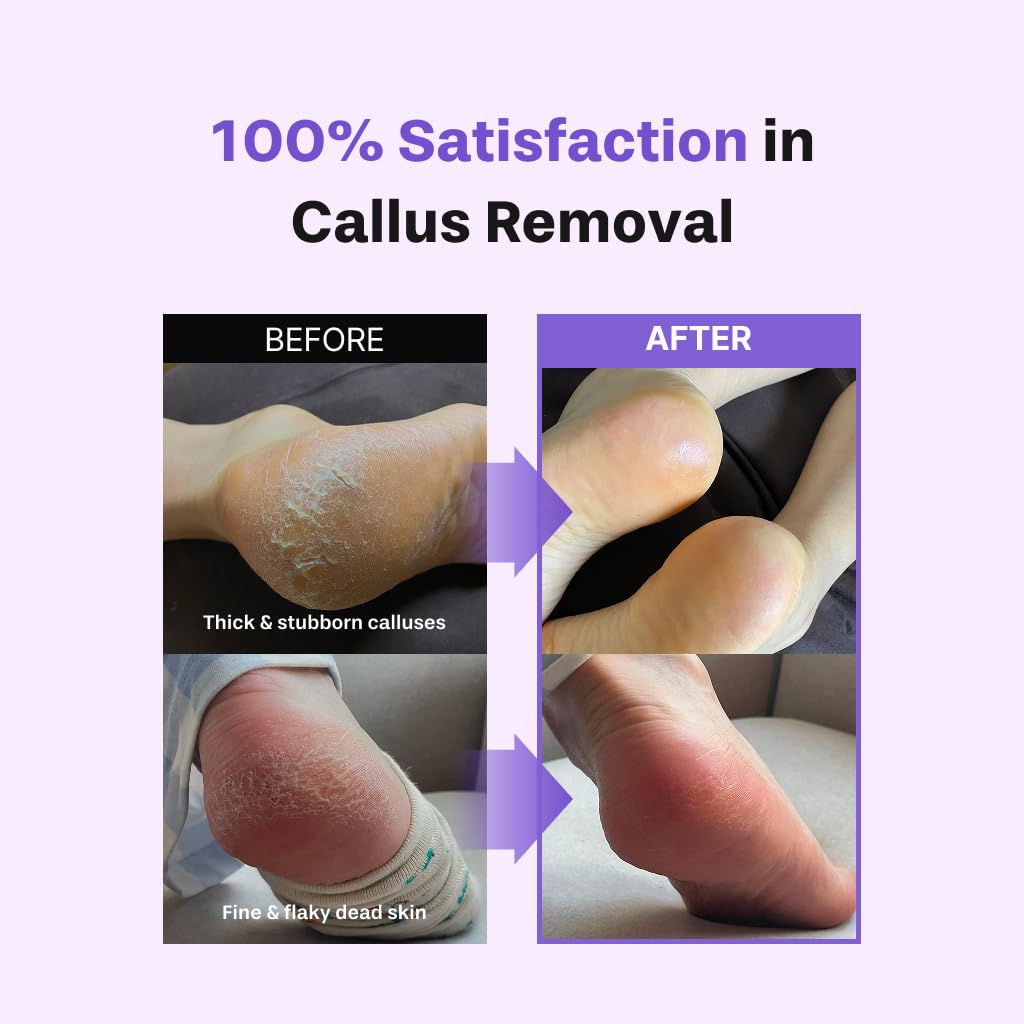 Baren professional foot care at home delivers salon-like results.