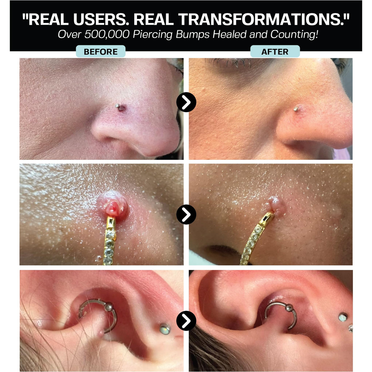 BASE LABORATORIES nose piercing cleaner spray for nose piercing care