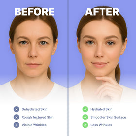 Bayside forehead wrinkle patches with retinol for firmer skin by morning.