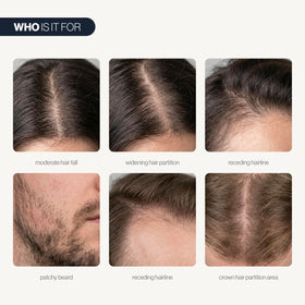 Close-up of serum drop on scalp suggests quick absorption and targeted care.