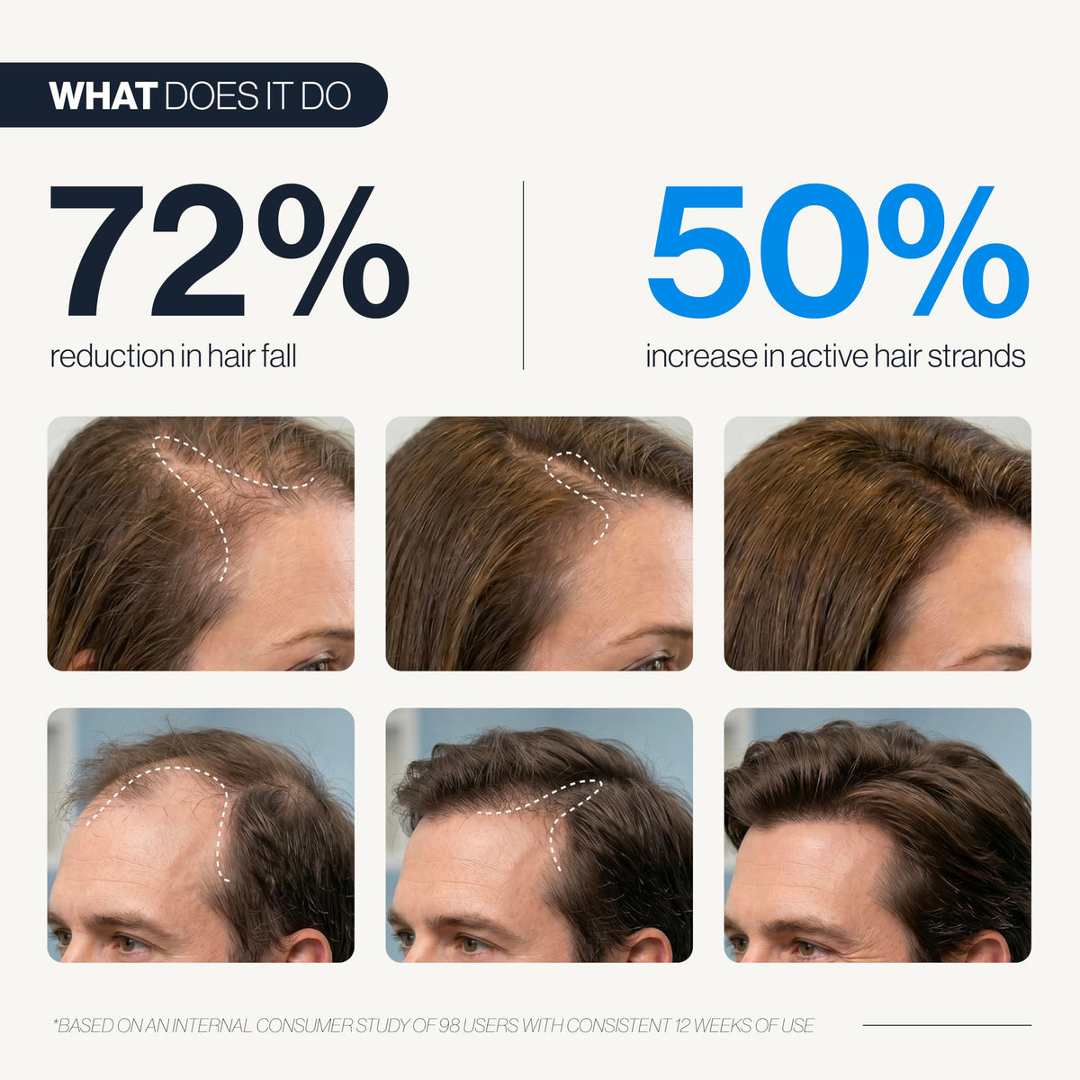 Be Bodywise roll-on applicator targets thinning areas for precise, mess-free application.