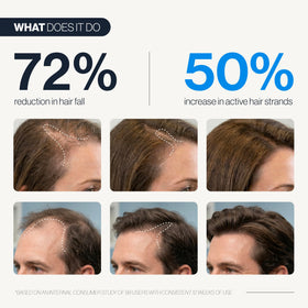 Be Bodywise roll-on applicator targets thinning areas for precise, mess-free application.