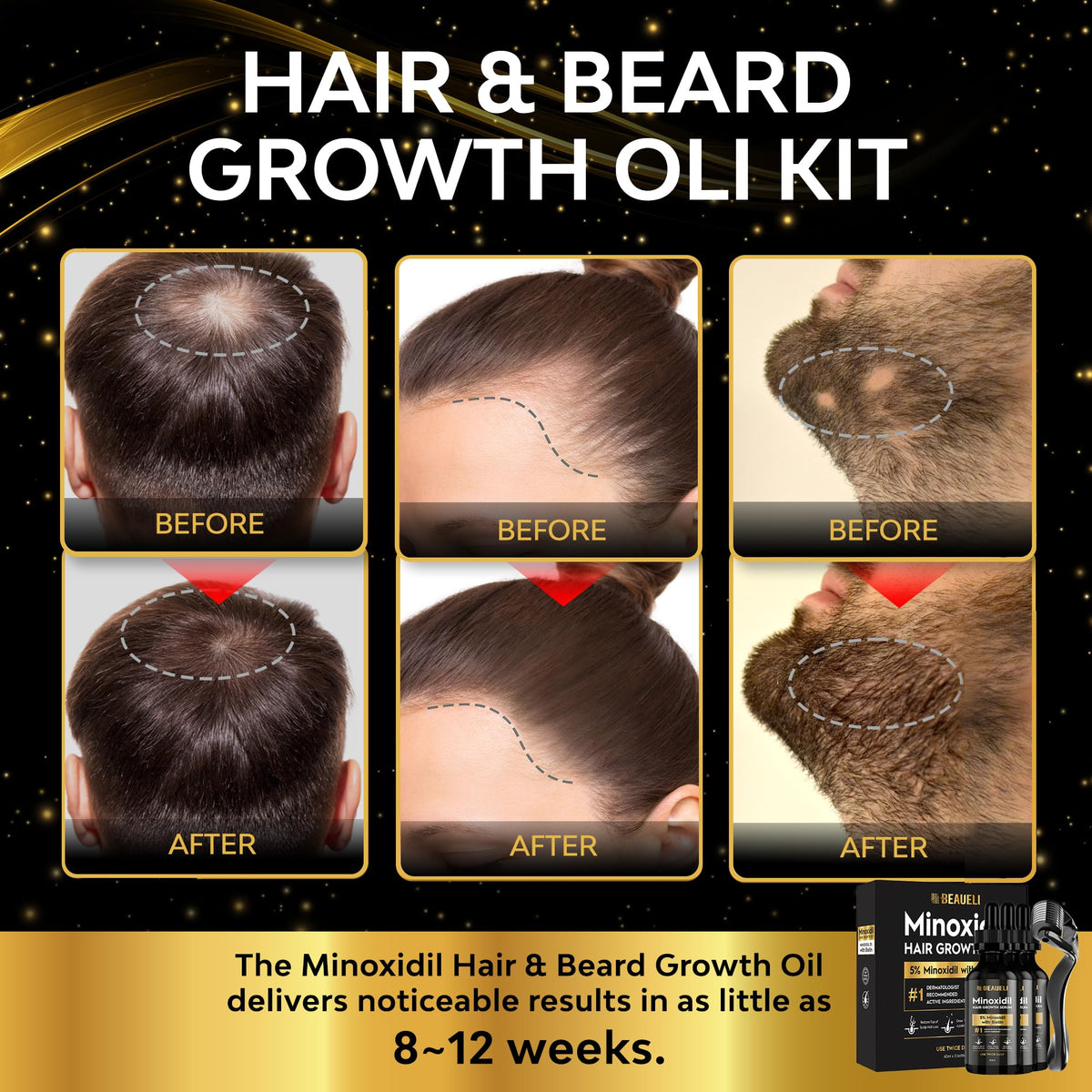 Beaueli beard growth kit multi-pack showing three bottles for steady routine