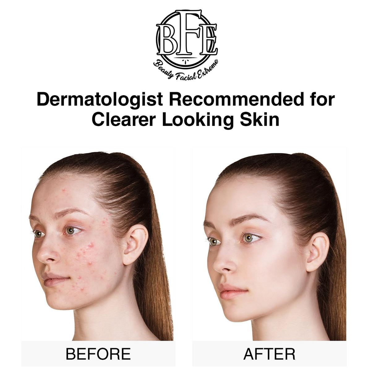 Beauty Facial Extreme pad applied to skin reducing oil and shine.