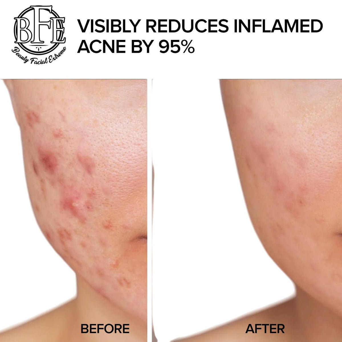 Beauty Facial Extreme for men, women, and teens demonstrates versatile use.