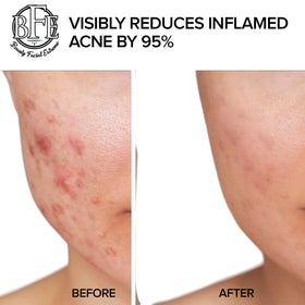 Beauty Facial Extreme for men, women, and teens demonstrates versatile use.