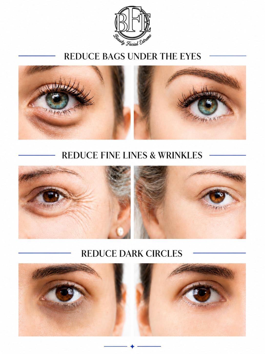 Beauty Facial Extreme smooths and firms the delicate eye area for a refreshed look