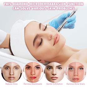 Beauty Star adjustable vacuum control for customizing suction intensity.