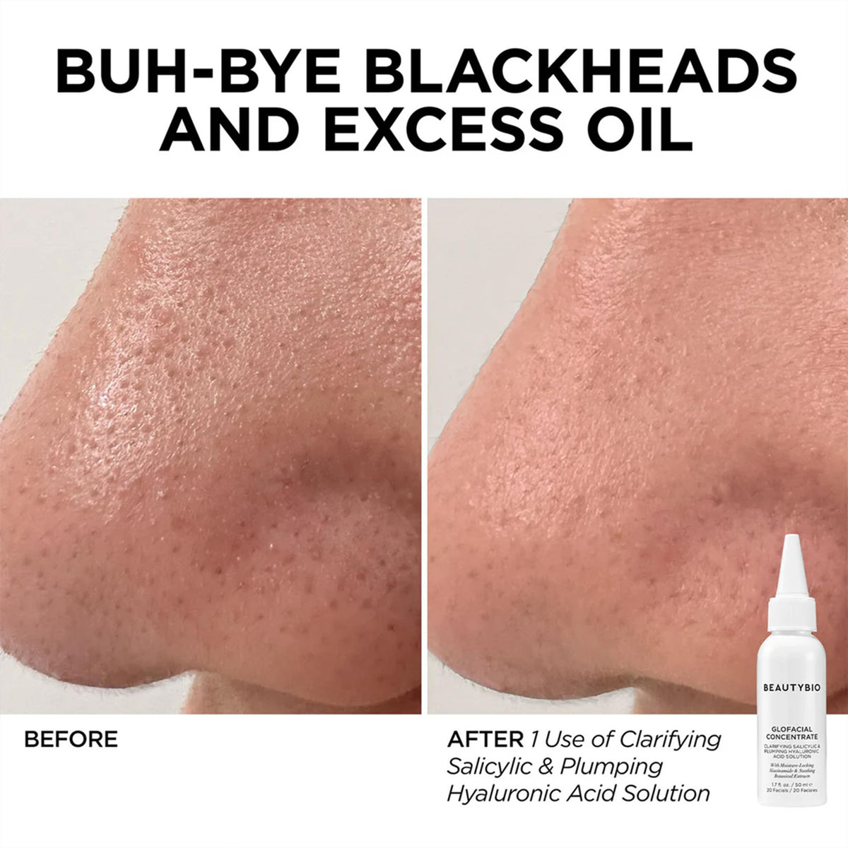 BeautyBio GLOfacial botanical extracts concentrate soothing and balancing skin