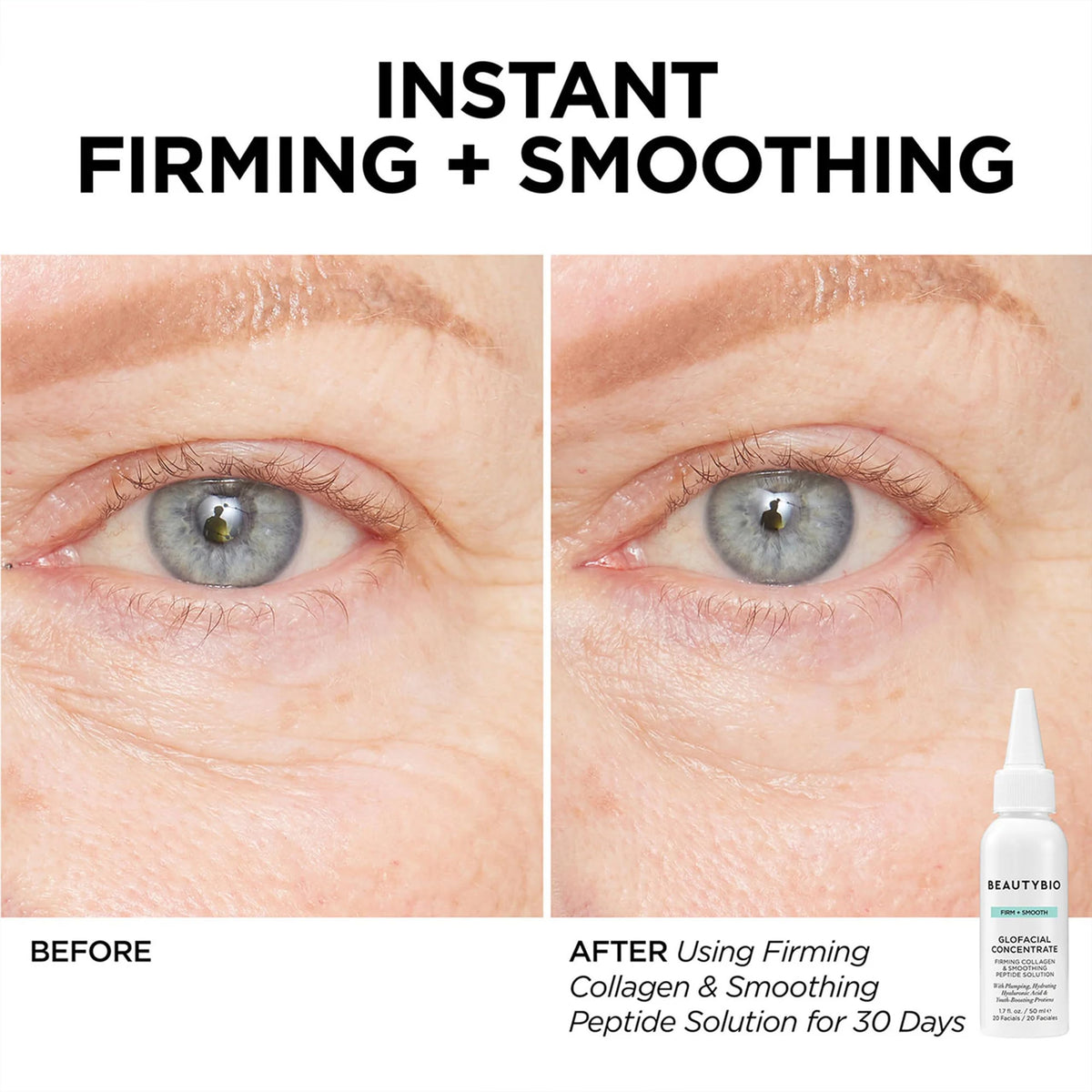 BeautyBio GLOfacial radiant skin result with cleaner, plumper-looking skin