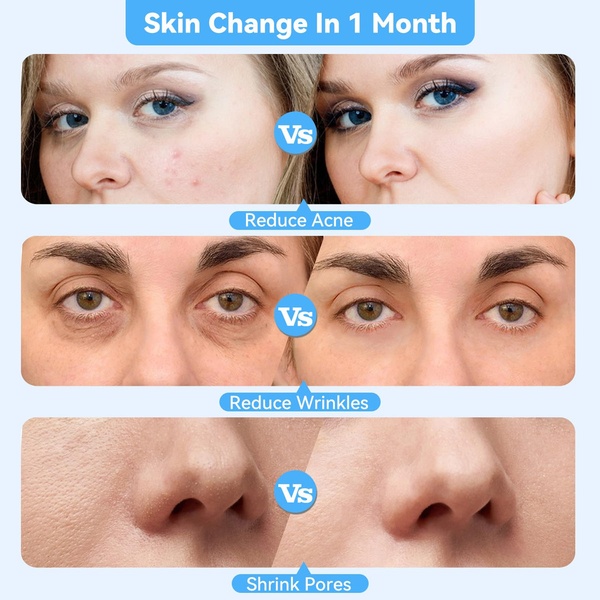 Beautycity diamond head on face area demonstrates dead skin removal and pore refinement.
