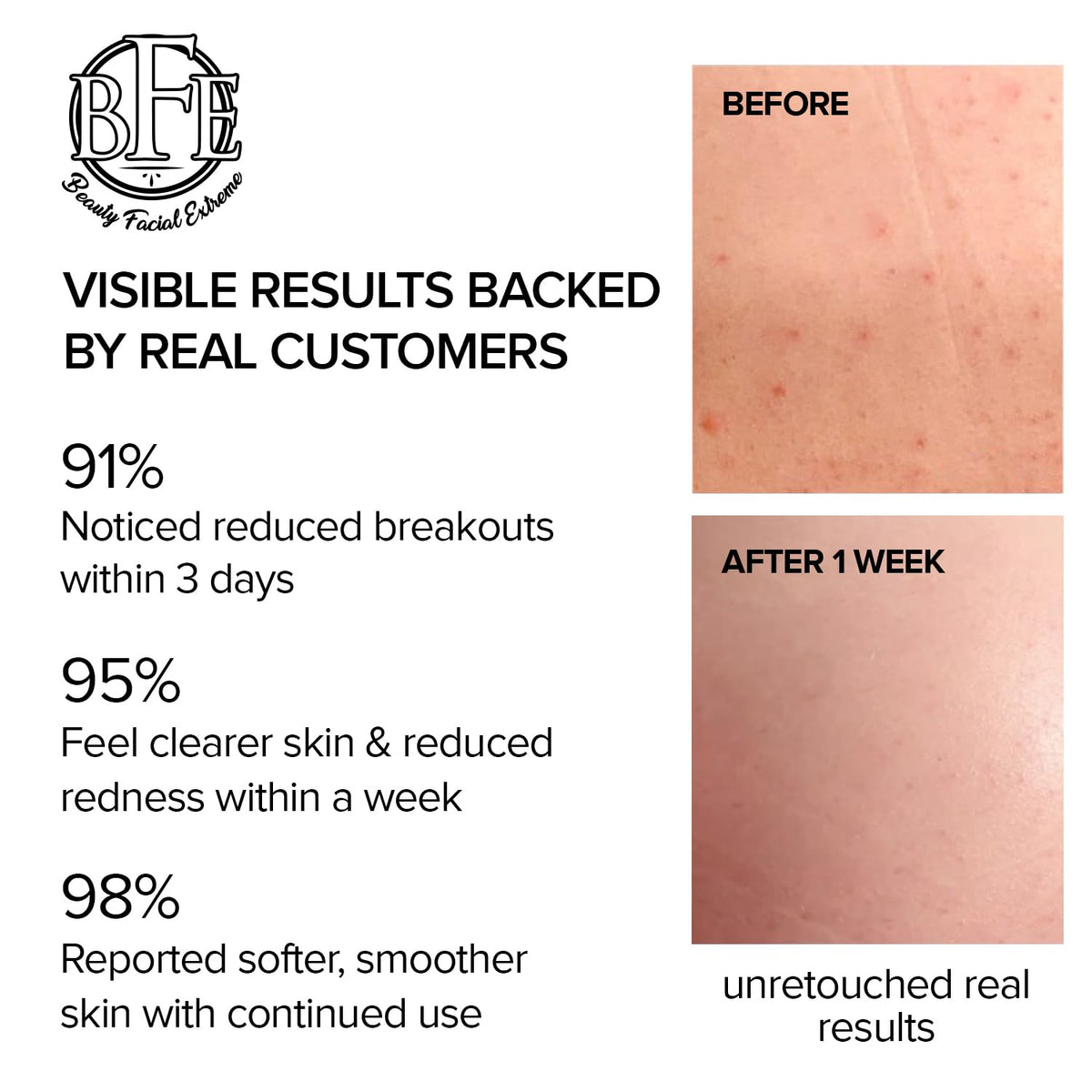 Beauty Facial Extreme rich emollients texture emphasizes soothing, moisturizing feel