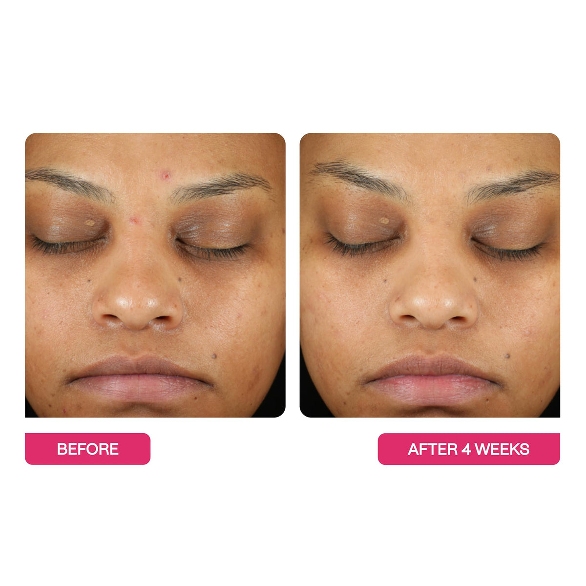 BeautyStat acid blend close-up demonstrates surface radiance and even texture benefits.
