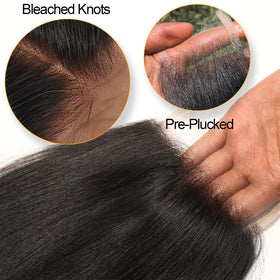 Beeos close-up of natural hairline for realistic scalp illusion.