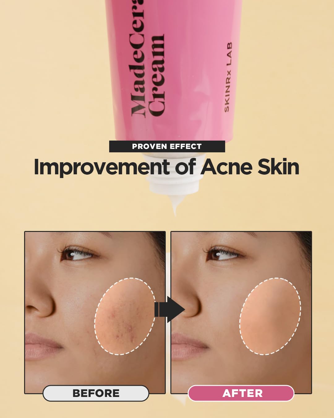 Packaging front of BEISIKS SKINRxLAB MadeCera Cream with key ingredients