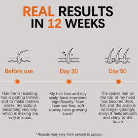 Belano's daily-dose capsules on a table scene highlighting routine use