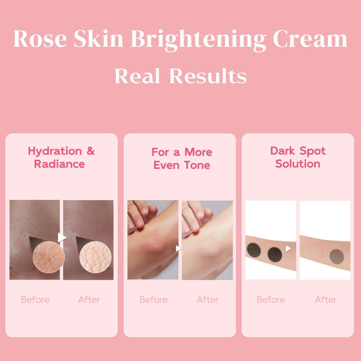BELIARST elbow area care for smoother appearance and hydration.