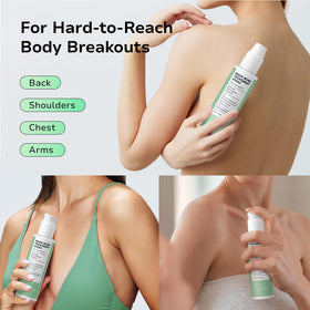 BellamiLuxx 2percent salicylic acid diffusion supports gentle exfoliation.