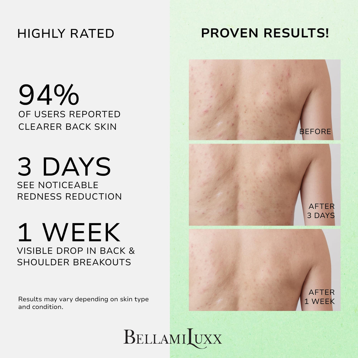 BellamiLuxx bacne spray mist on back demonstrates quick, mess-free coverage.