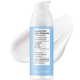 BellamiLuxx Folliculitis Lotion bottle for daily body care and gentle pore refinement.