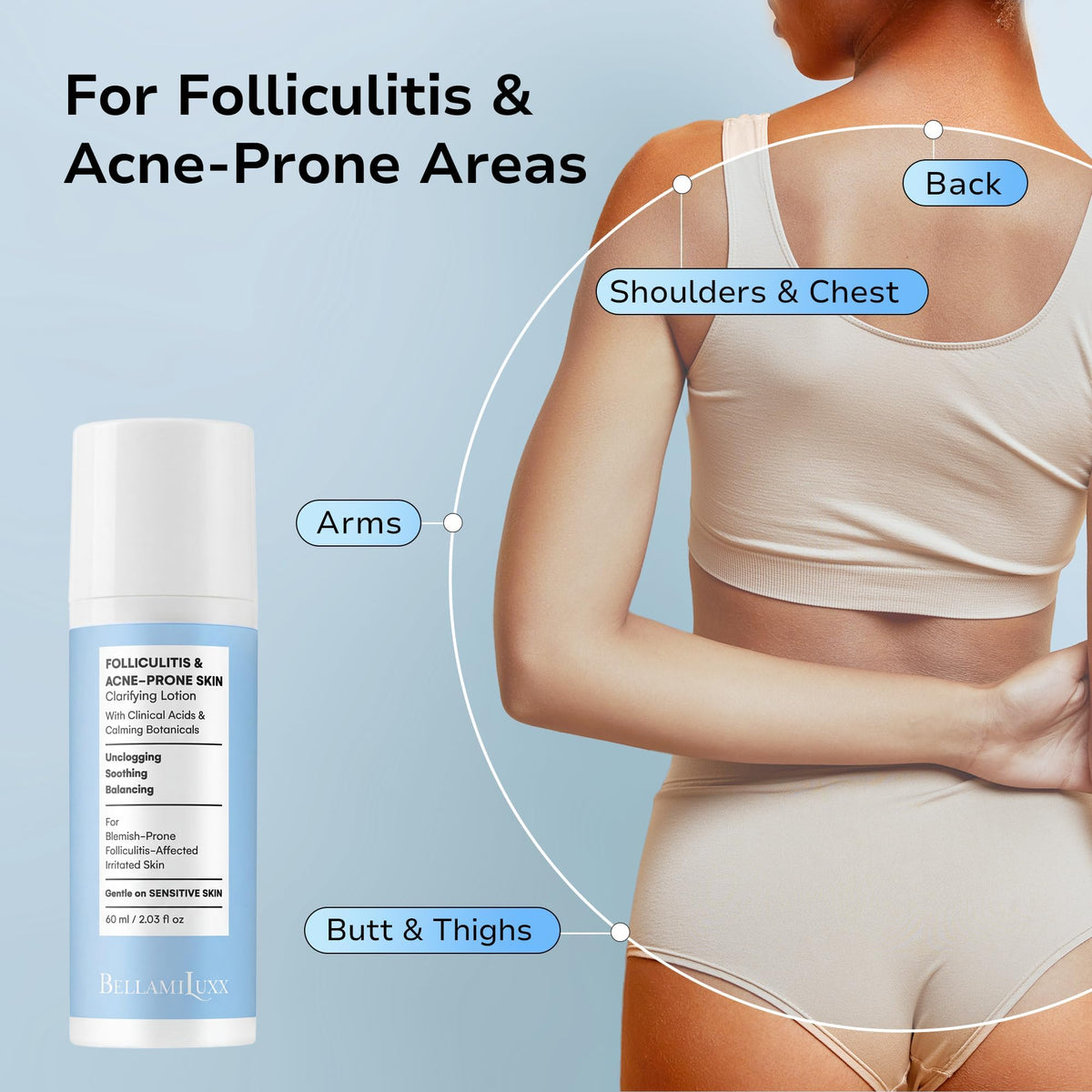 BellamiLuxx Folliculitis Lotion box-packaging on shelf for convenient home use.