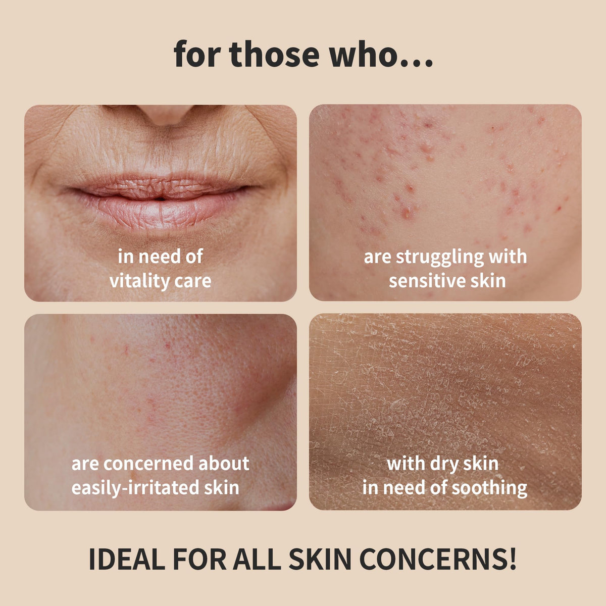 BENTON Snail Bee High Content Toner ingredients scene highlights snail mucin and bee venom benefits