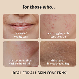 BENTON Snail Bee High Content Toner ingredients scene highlights snail mucin and bee venom benefits