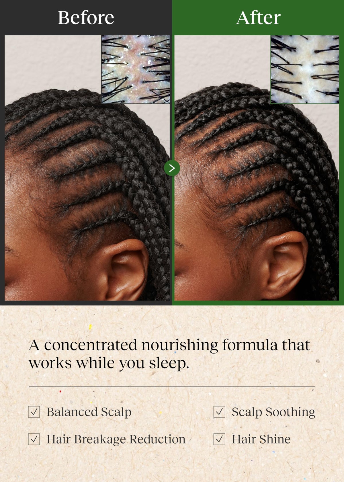 Bephor Braid Rev Scalp Oil Balm bottle label highlights 3-in-1 benefits.