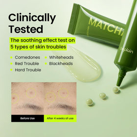 Close-up of tube applicator illustrating precise spot-focused application for brightening.