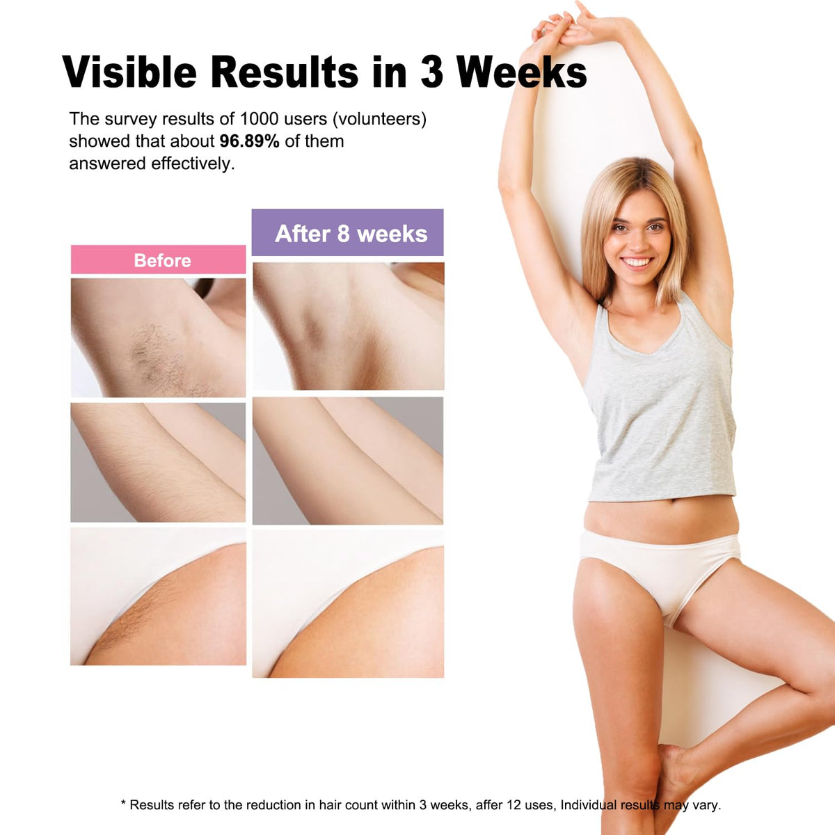 BETNEP AI08 bikini-line treatment for smooth personal care at home.