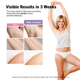 BETNEP AI08 bikini-line treatment for smooth personal care at home.