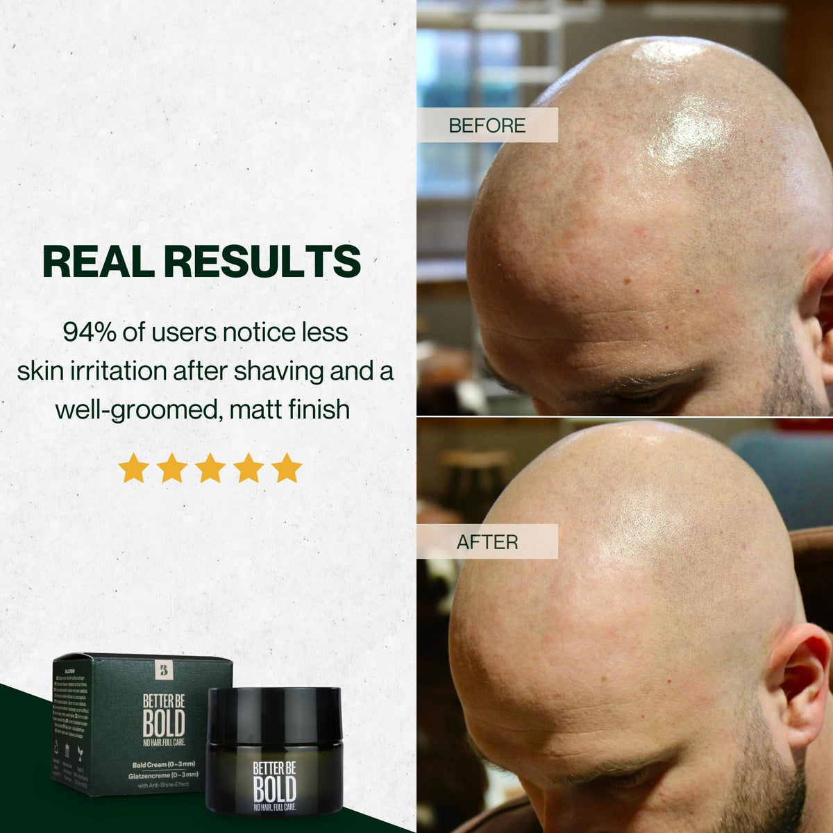 BETTER BE BOLD Shea butter and jojoba oil nourish sensitive scalp.