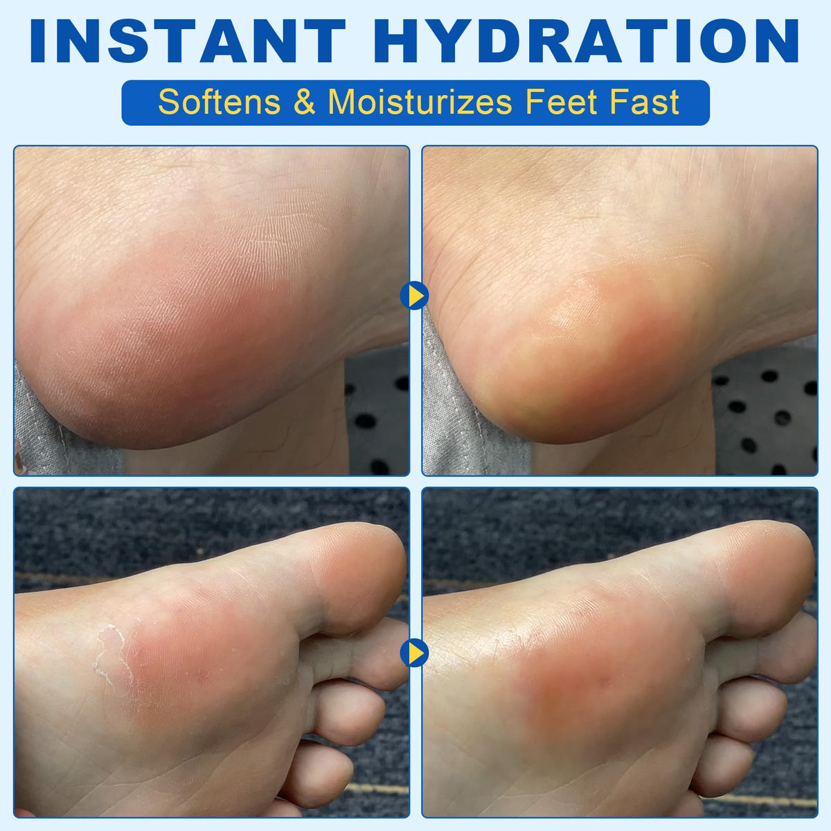Bieyoc cream stick dries quickly for immediate dressing.