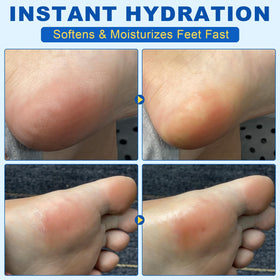 Bieyoc cream stick dries quickly for immediate dressing.