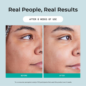 Face and neck use with all skin types in mind